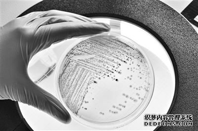图为在培养皿中生长的大肠杆菌。 视觉中国供图